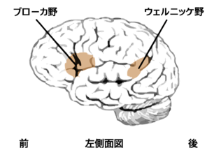 ウェルニッケ野およびブローカ野 (ウェルニッケ野(wikipedia))